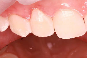 img-after