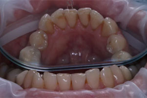 img-before