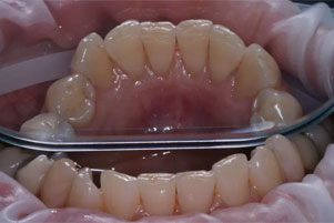 img-after