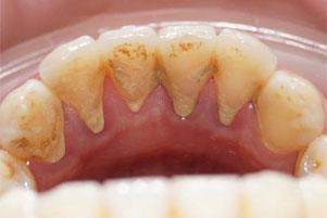 img-before
