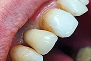 img-after