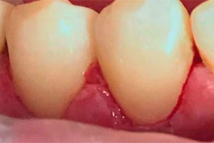 img-after