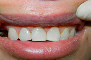 img-after