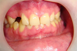 img-before