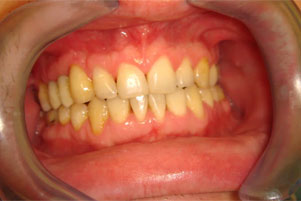 img-after