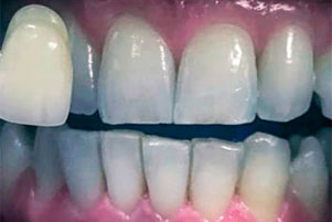 img-before
