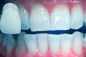 img-after