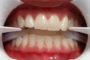 img-after