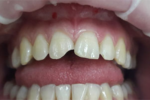 img-before
