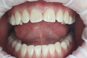 img-after