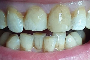 img-before