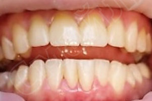 img-after