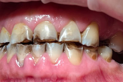 img-before