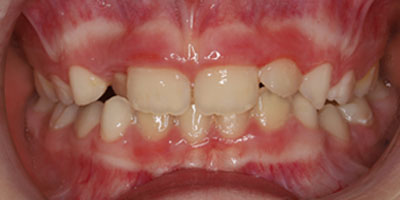 img-before