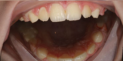 img-after