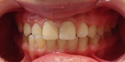 img-before